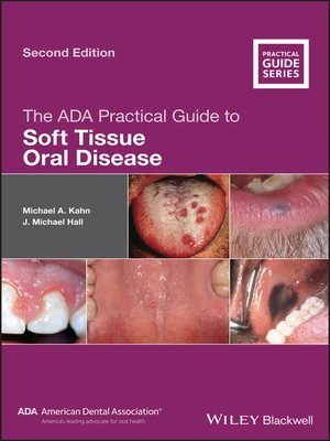 cover image of The ADA Practical Guide to Soft Tissue Oral Disease